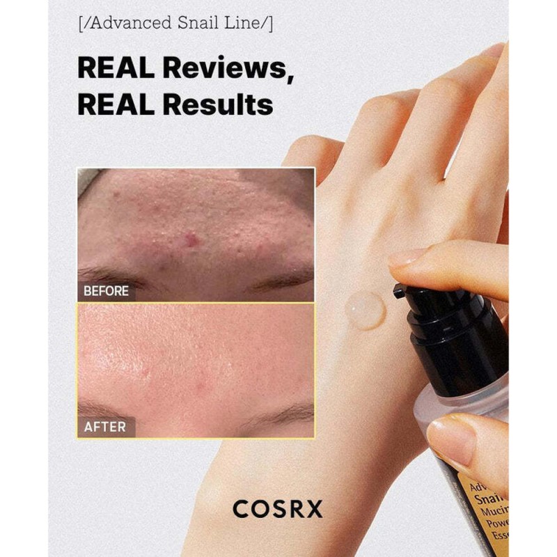 COSRX Advanced Snail 96 Mucin Power Essence 100ml - Ορός Ανάπλασης & Ενυδάτωσης